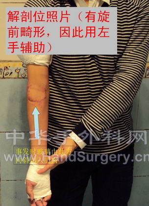 解剖位正面.jpg
