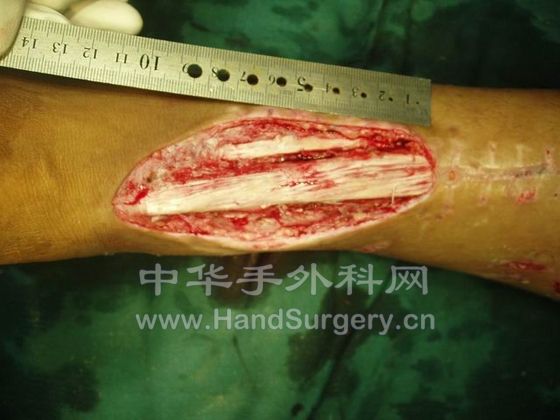 郑钞仁07 (4).JPG