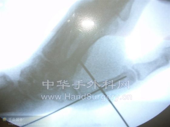 所得税.jpg