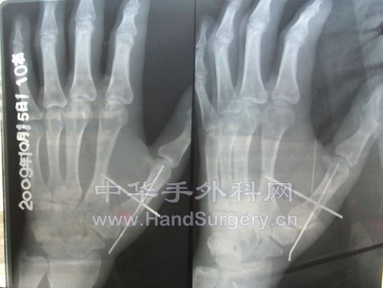 死的死的所得税的是.jpg