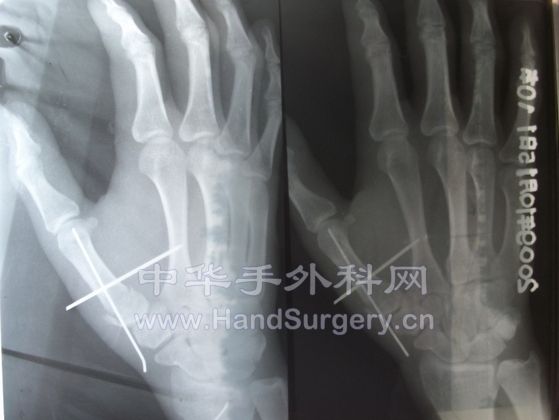 所得税死的.jpg