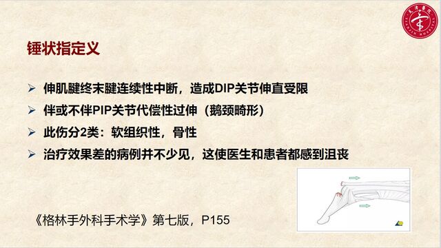 微信截图_20250601234825.png