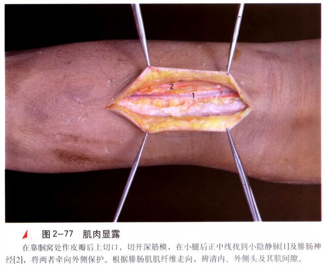 微信截图_20250604000145.png