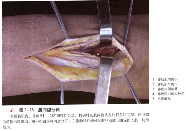 微信截图_20250604000235.png