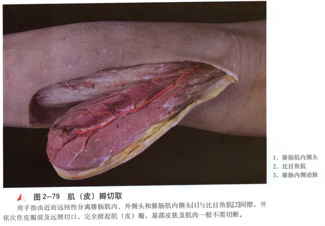 微信截图_20250604000359.png