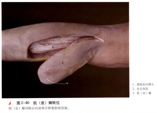 微信截图_20250604000436.png