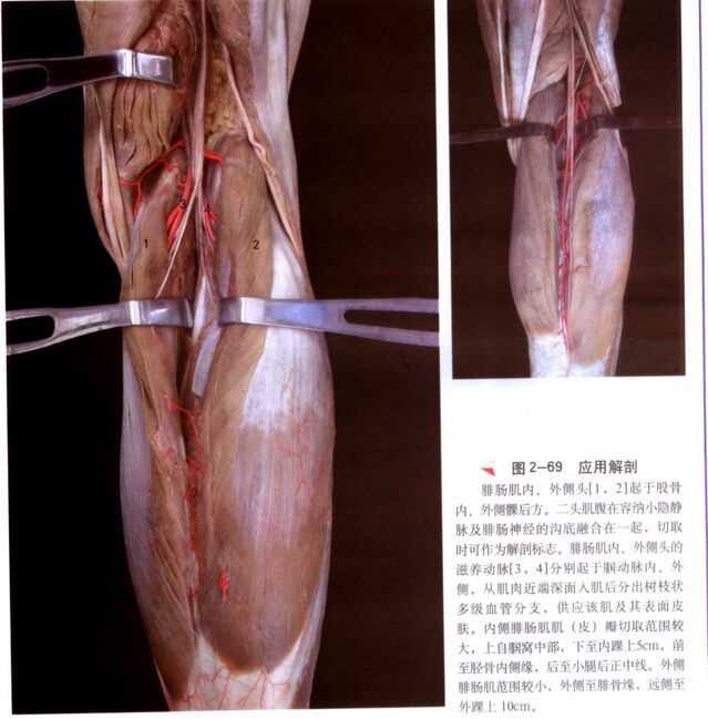 微信截图_20250603235902.png