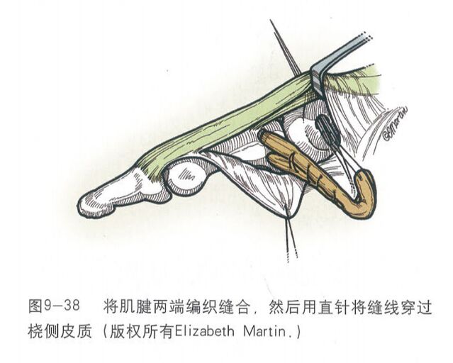 微信图片_20250617200937.png