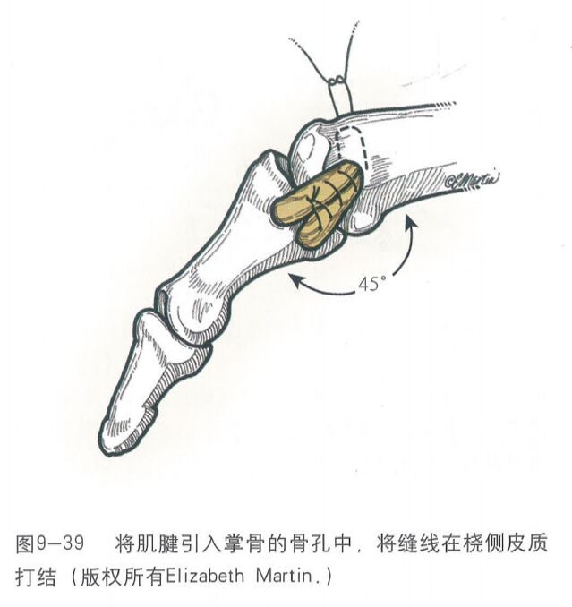 微信图片_20250617200940.png