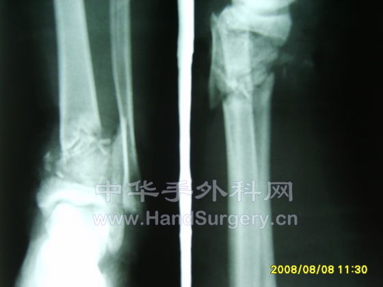 S8000736.JPG