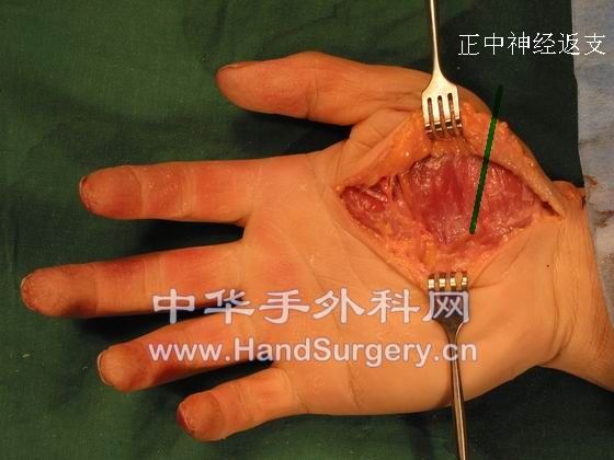 d8b3.jpg.thumb.jpg