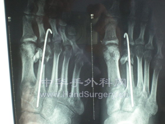 DSCN1375.JPG