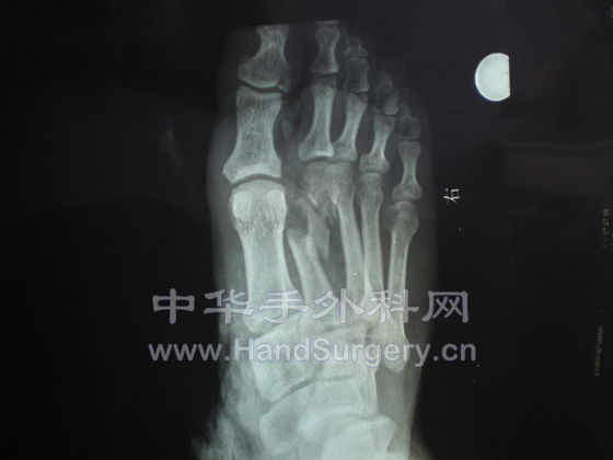 DSCN1372.JPG