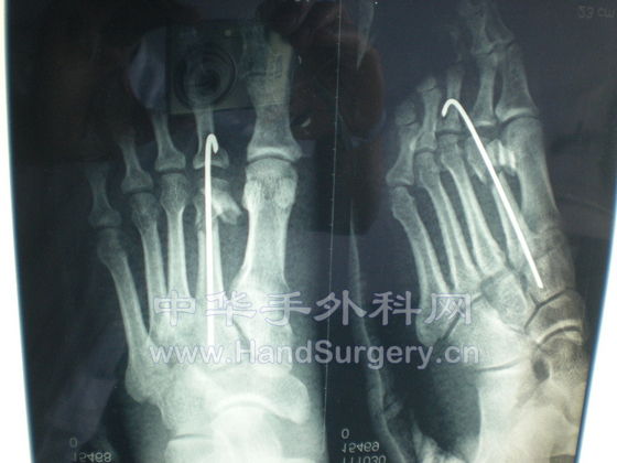 DSCN1373.JPG