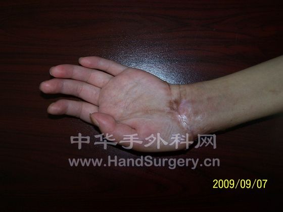 100_5730.JPG