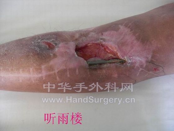 调整大小 http_imgloadeqwe.jpg