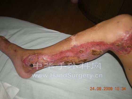 骨科手术入路解剖学 002.jpg