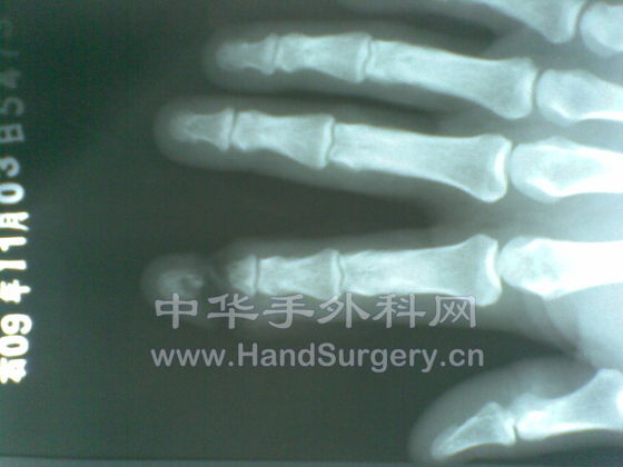 20091103(003).jpg