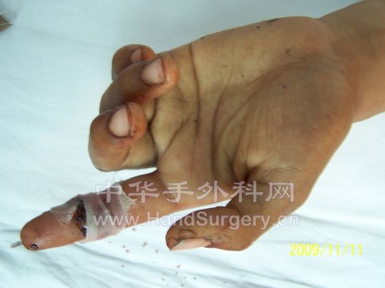 100_6182.JPG