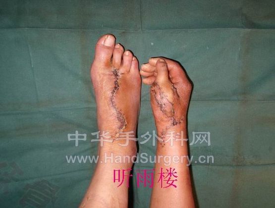 旋转 旋转 调整大小 2009-11-11 162.jpg