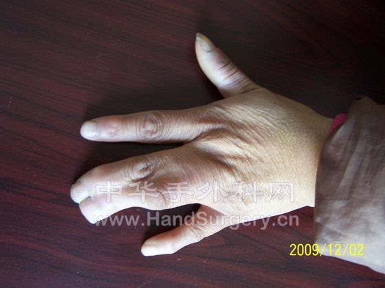 100_6301.JPG