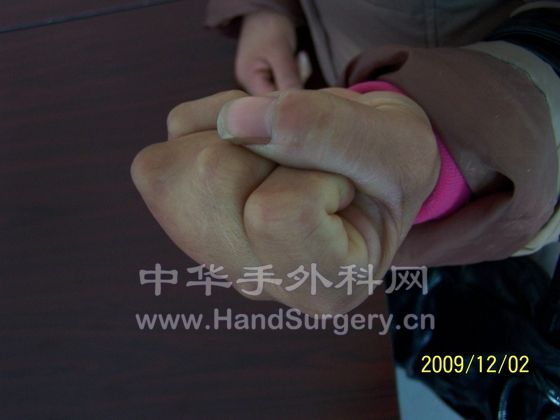 100_6304.JPG