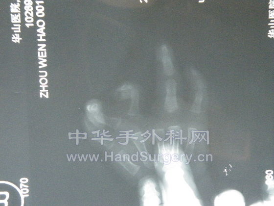 DSCF2735.JPG