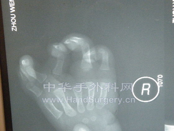 DSCF2736.JPG