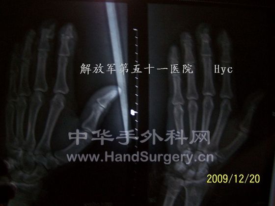 100_6552.JPG