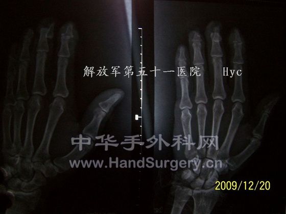 100_6553.JPG