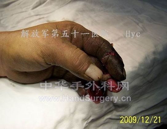 100_6562.jpg