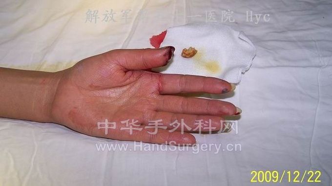 100_6572.jpg