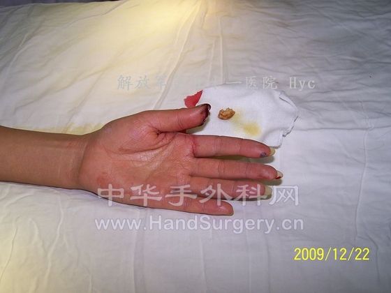 100_6573.JPG