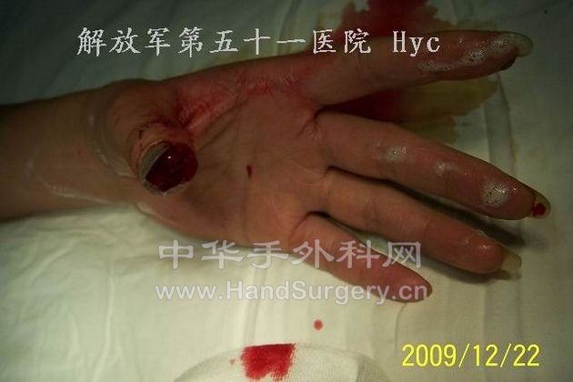 100_6574.jpg