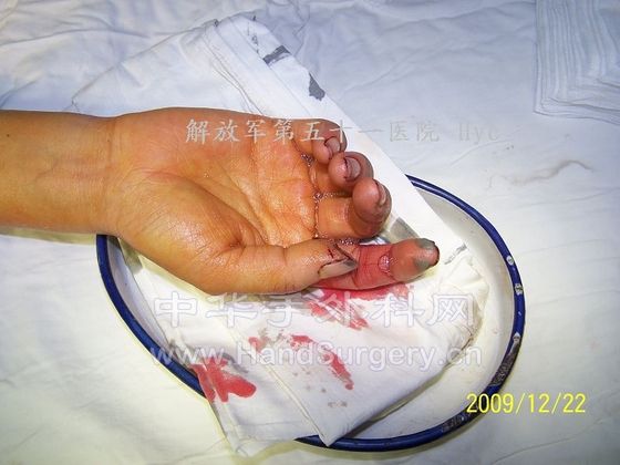100_6579.JPG