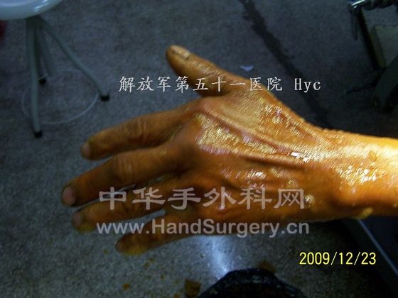 100_6602.JPG