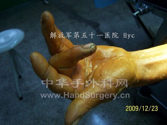100_6605.JPG