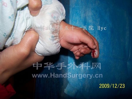 100_6627.JPG