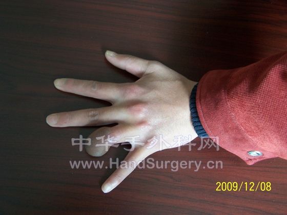 100_6393.JPG