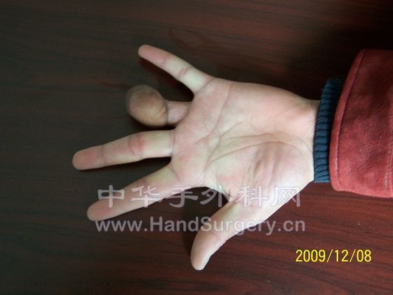 100_6395.JPG