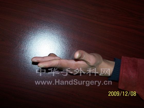 100_6400.JPG