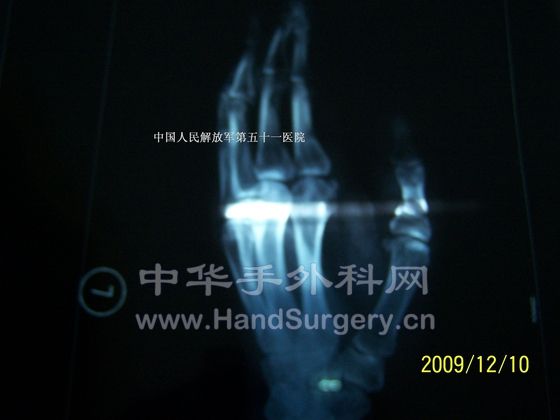 100_6443.JPG
