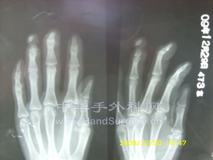 SN850710.JPG