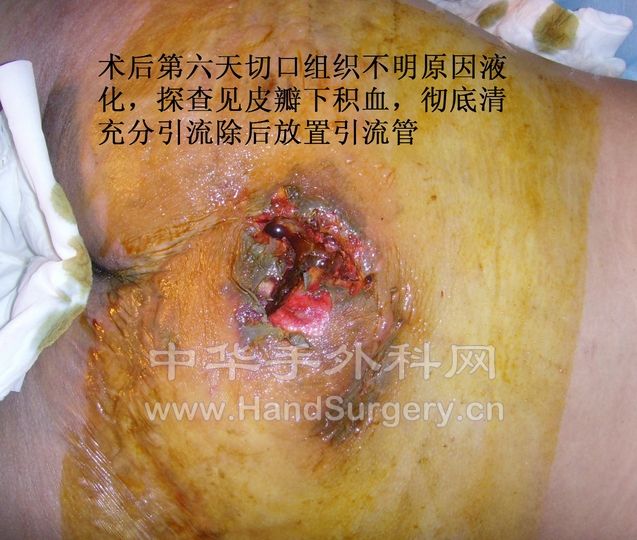 SNV34895.JPG