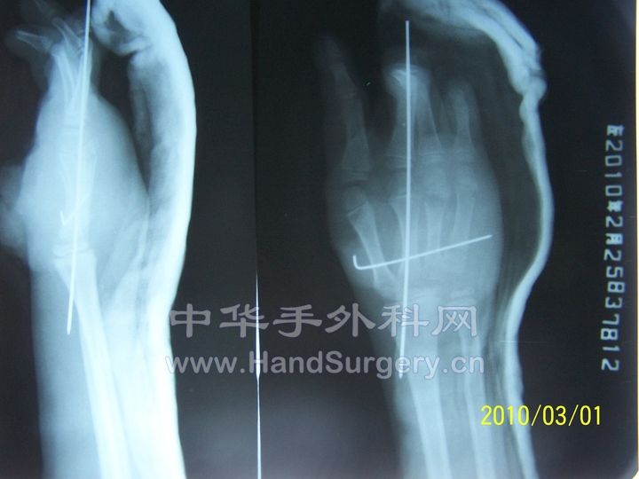 100_7247.JPG