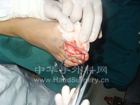 SDC11555.JPG