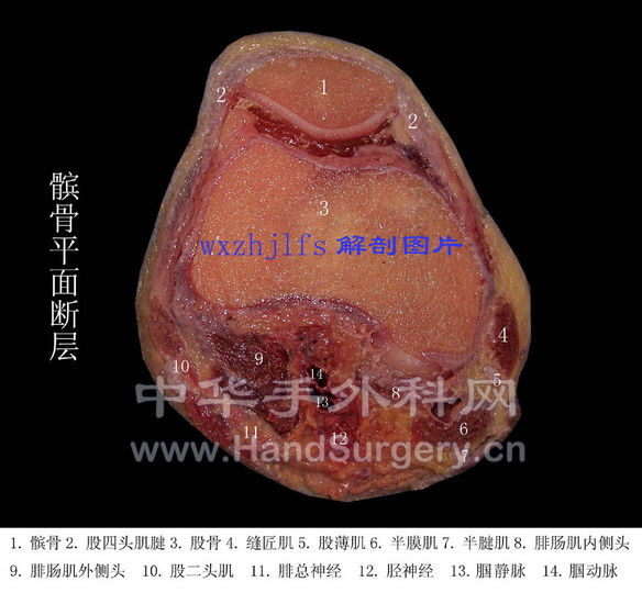 309A04.JPG