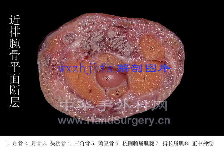 7001A06.JPG