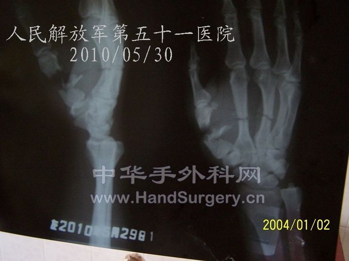100_8407.JPG