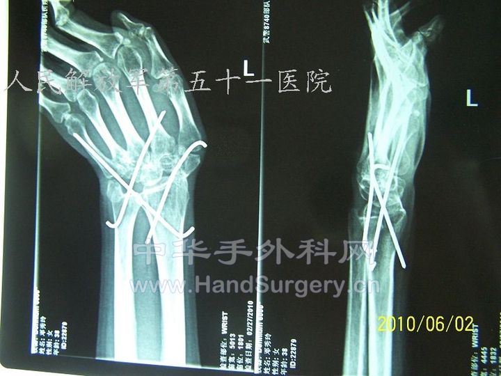 100_8446.JPG